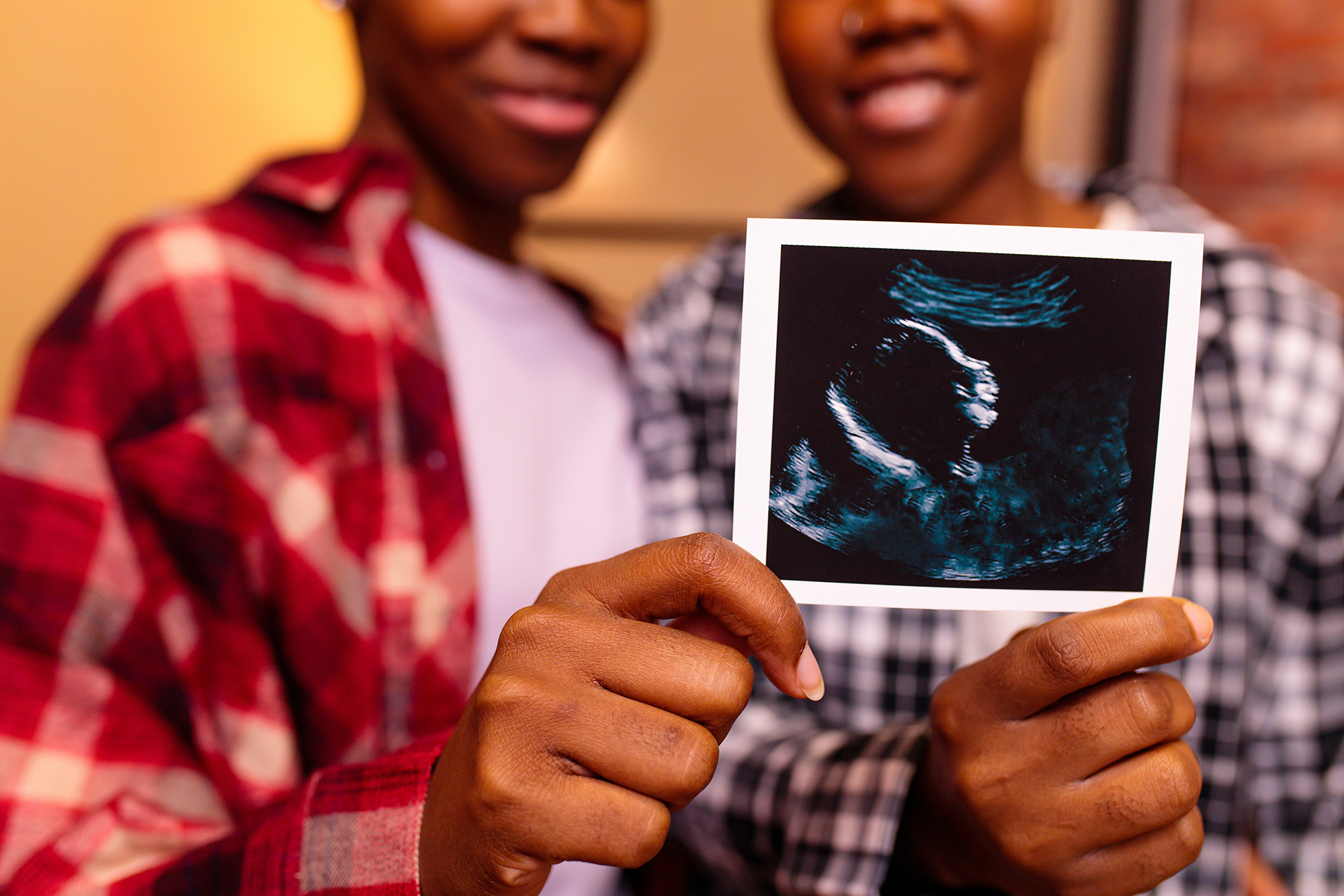 "Two women stand next to each other in the background holding up an ultrasound photo together"